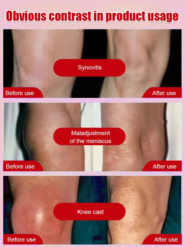 【Far infrared joint pain relief gel】Fast-acting comfort for aching joints, so you can get back to what you love!