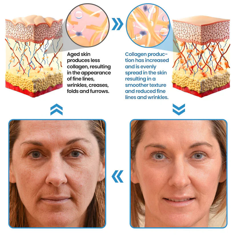 Biancat® Collagen Peptide Serum