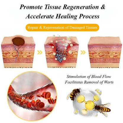 BOOMOON Bee Venom  Treatment Spray