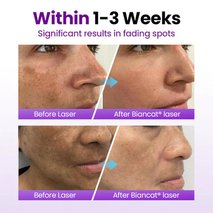 Biancat® SpotErase Probiotic Shield Serum