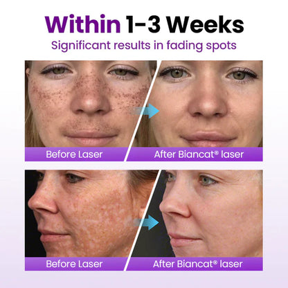 Biancat® SpotErase Probiotic Shield Serum