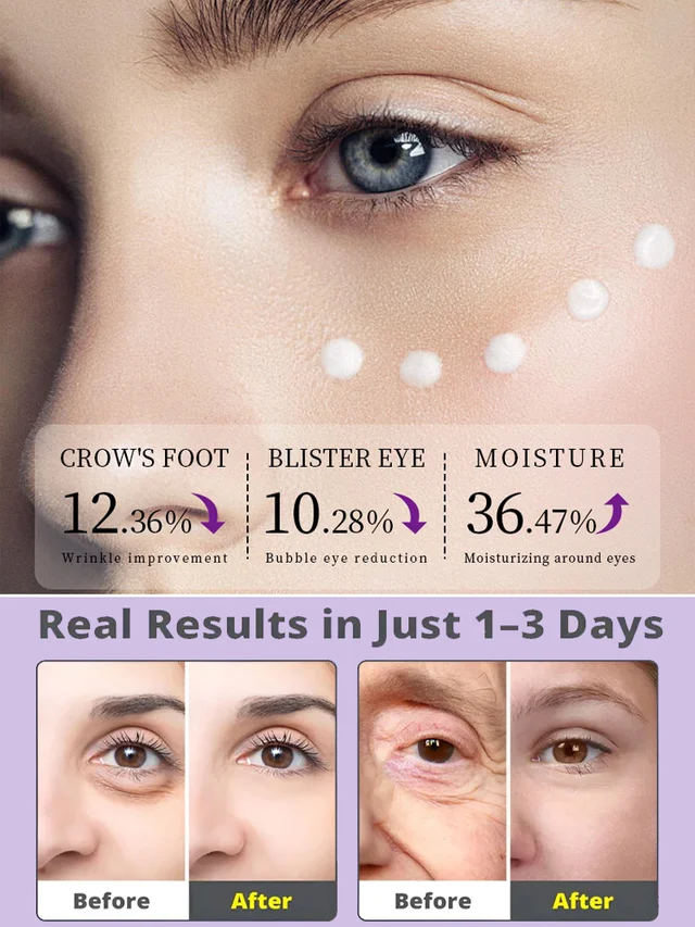 [5 times anti-wrinkle] Firming Repair Eye Cream