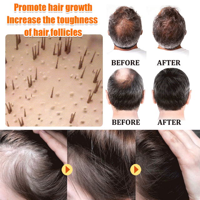 EELHOE Biotin Hair Growth Spray