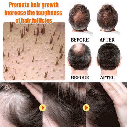 EELHOE Biotin Hair Growth Spray