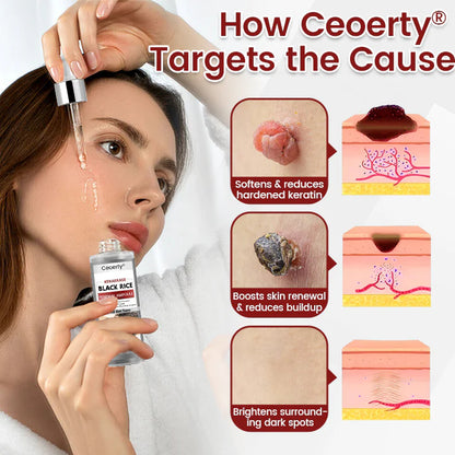 Ceoerty® KeraErase Black Rice Renewal Ampoule