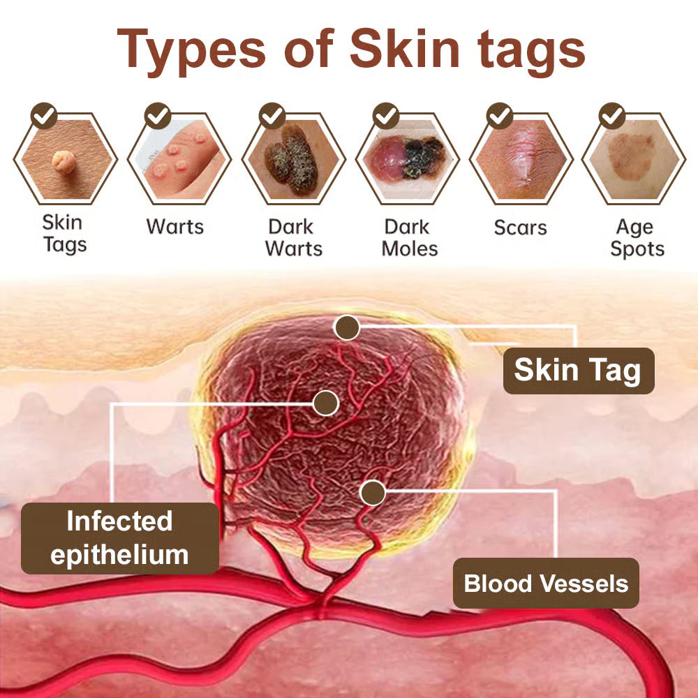 LOVILDS® Black Rice Skin Repair Essence Cream