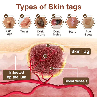 LOVILDS® Black Rice Skin Repair Essence Cream