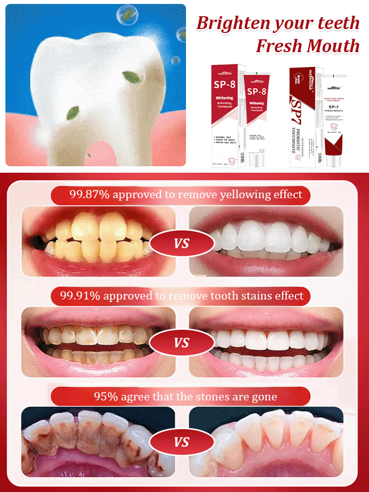 【Latest Model】SP7SP8 Probiotic Whitening Toothpaste