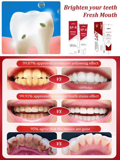【Latest Model】SP7SP8 Probiotic Whitening Toothpaste