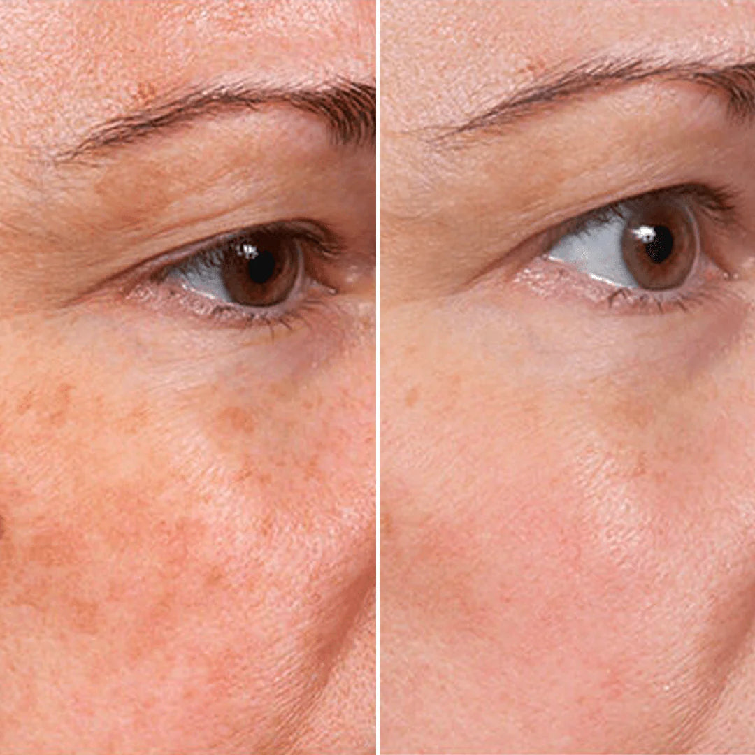 Rejuvenate Face Serum 🌿The 5-in-1 natural multi-weight formula that fixes eye bags, wrinkles, and dark spots.