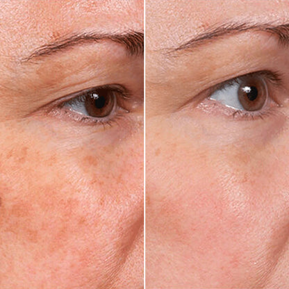 Rejuvenate Face Serum 🌿The 5-in-1 natural multi-weight formula that fixes eye bags, wrinkles, and dark spots.