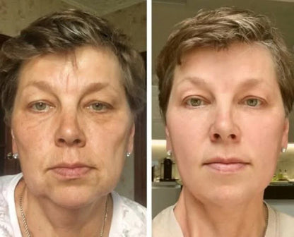 🐝🌿Ringmiz Botox BeeVenom Firming SerumStick-(Made and shippedfrom Australia)-LASTDAY 70% OFF