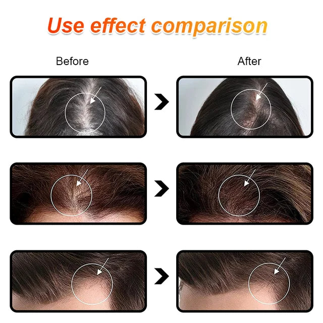 Batana Oil for Strengthening Hair and Preventing Hair Loss--Experience visible hair regrowth—nourish your scalp, revive your look!