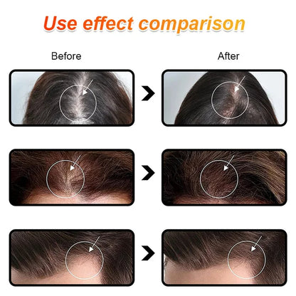 Batana Oil for Strengthening Hair and Preventing Hair Loss--Experience visible hair regrowth—nourish your scalp, revive your look!