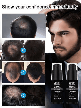 HOEGOA Hair Concealer