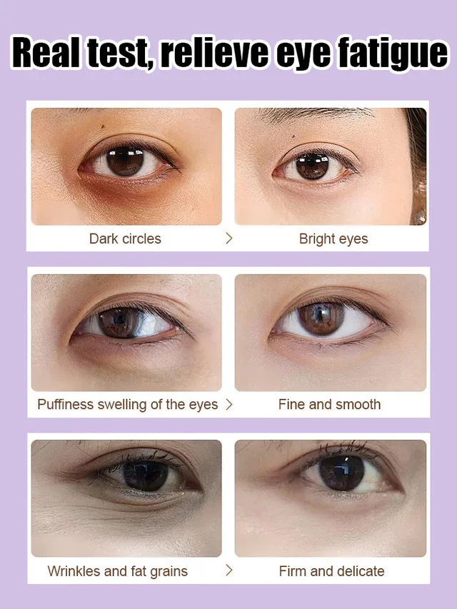 [5 times anti-wrinkle] Firming Repair Eye Cream