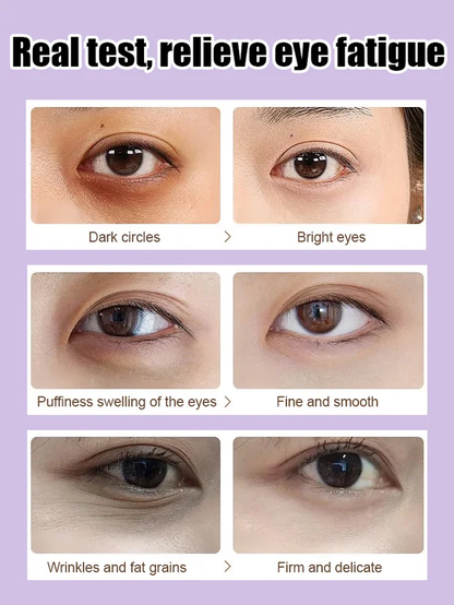 [5 times anti-wrinkle] Firming Repair Eye Cream