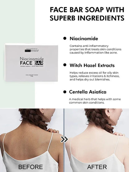 Niacinamide Whitening Soap