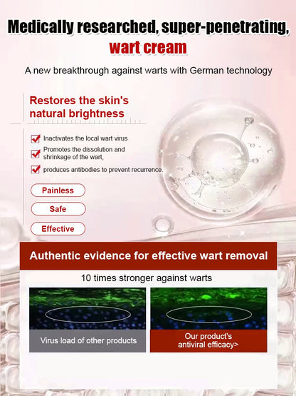"One-Second Wart Removal" Wart Shedding Cream