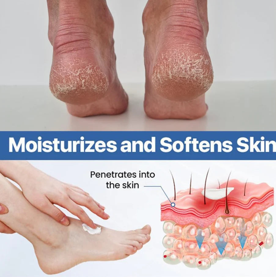 Diabetics Skin Relief cream