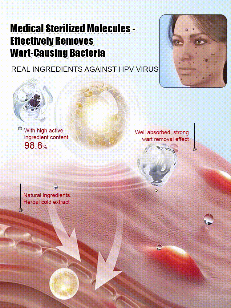 "One-Second Wart Removal" Wart Shedding Cream