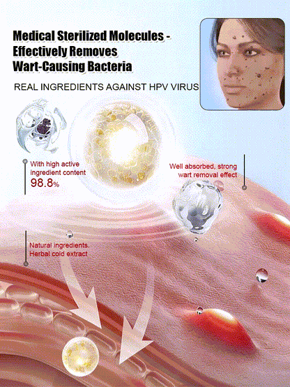 "One-Second Wart Removal" Wart Shedding Cream