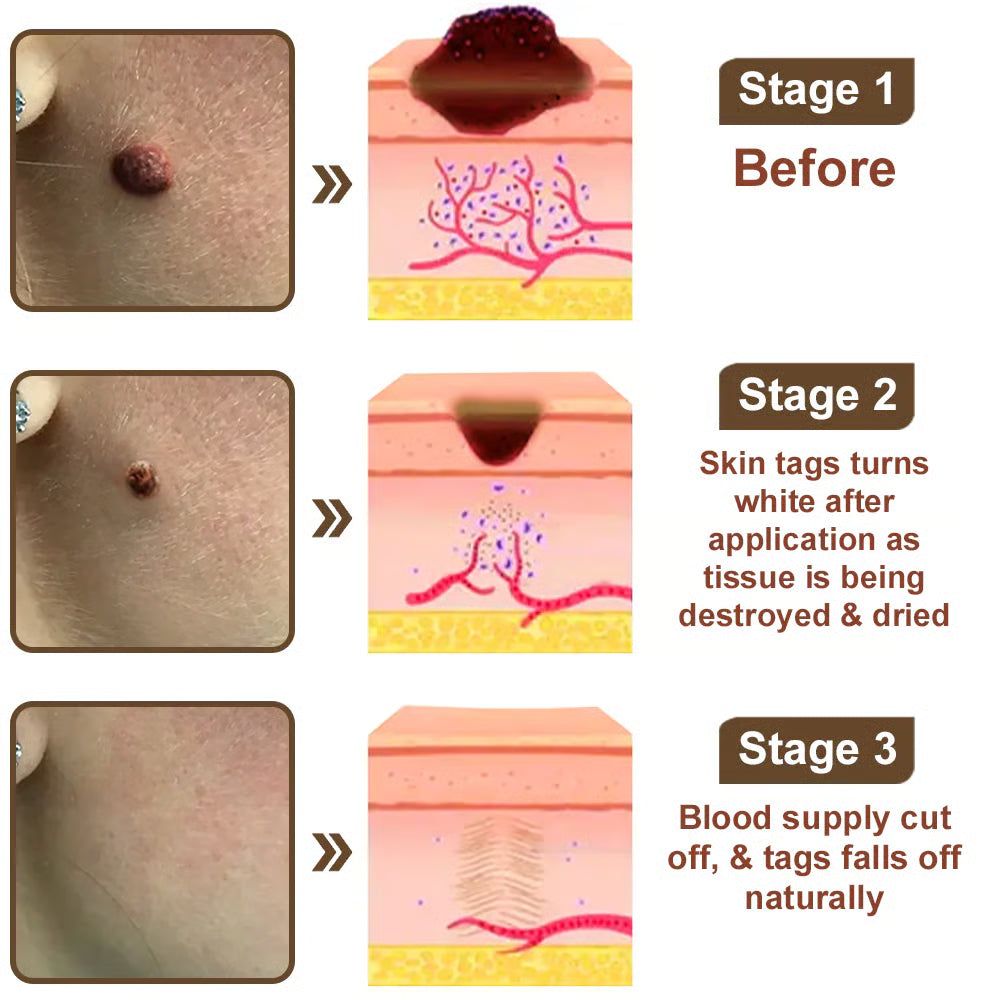 LOVILDS® Black Rice Skin Repair Essence Cream