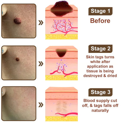 LOVILDS® Black Rice Skin Repair Essence Cream