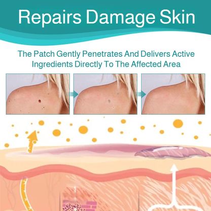 Patch Wart Flesh Mole Acne Patch Beauty Skin Care No Pain Easy To Operate