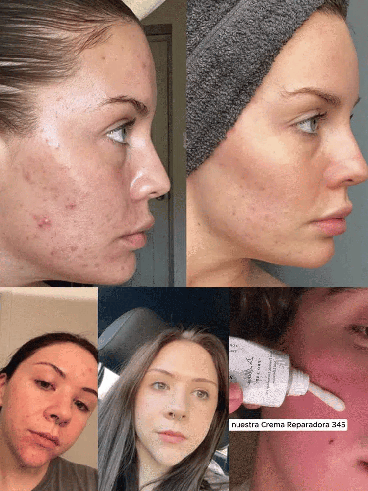 345 Skin Hydrating and Nourishing Cream