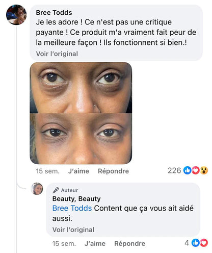 🐝🌿Ringmiz Botox BeeVenom Firming SerumStick-(Made and shippedfrom Australia)-LASTDAY 70% OFF