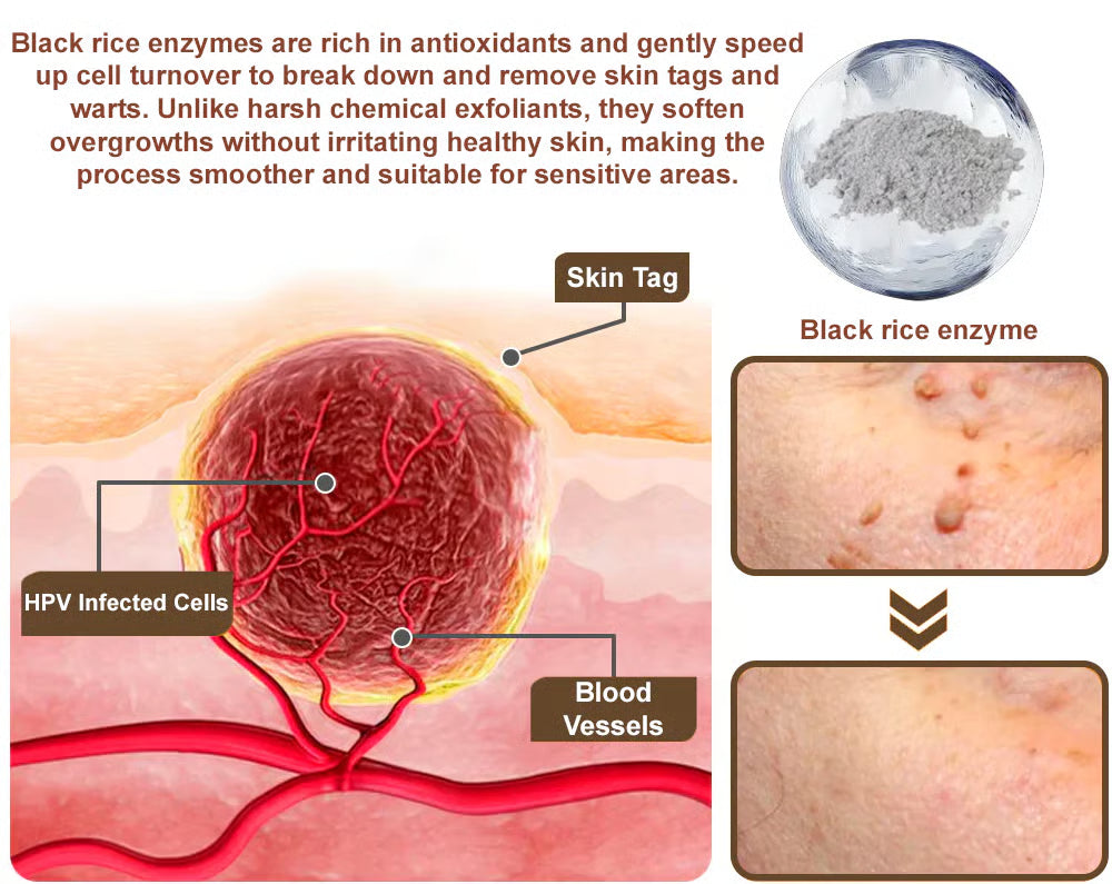 LOVILDS® Black Rice Skin Repair Essence Cream