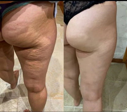 🐝🌿Ringmiz Botox BeeVenom Firming SerumStick-(Made and shippedfrom Australia)-LASTDAY 70% OFF