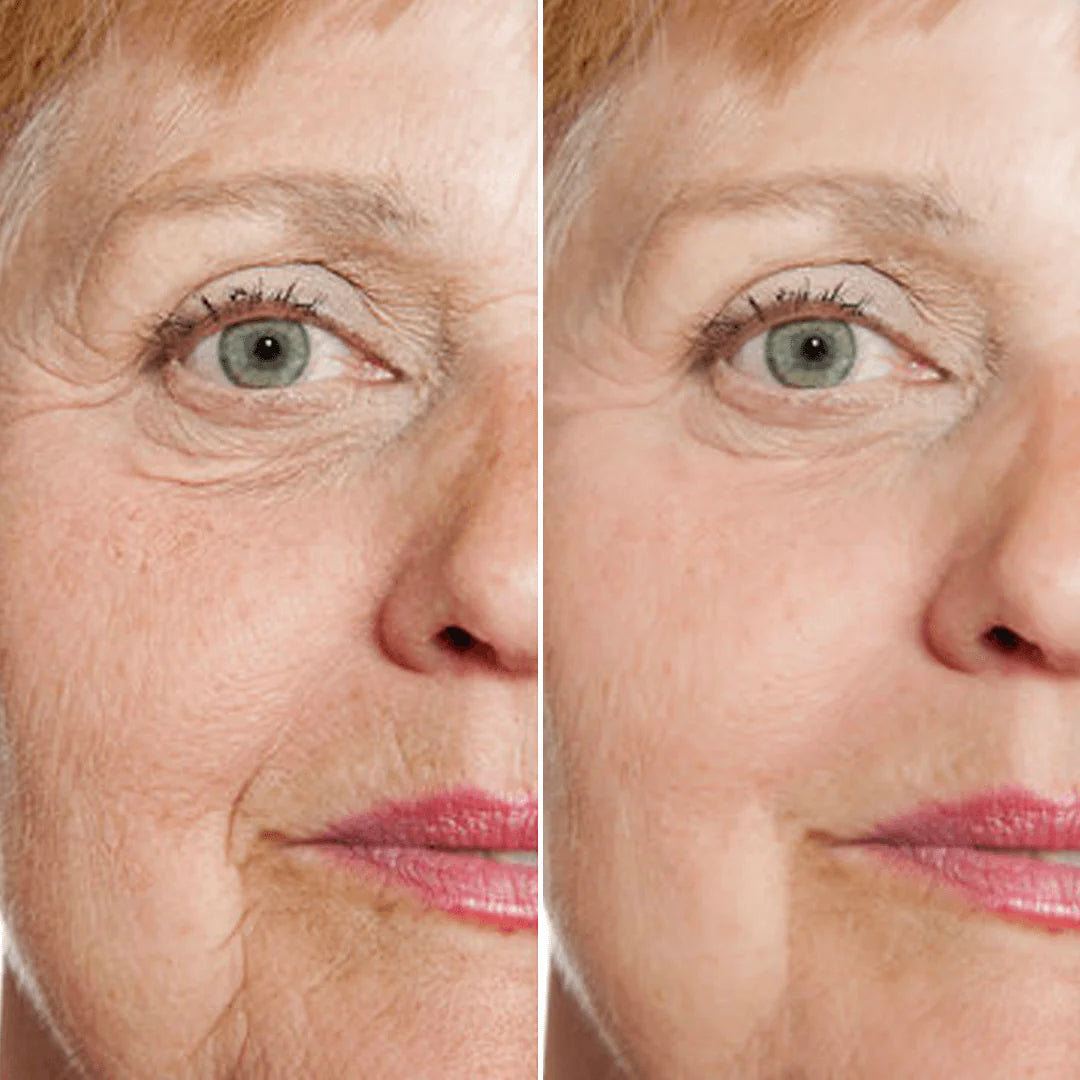 Rejuvenate Face Serum 🌿The 5-in-1 natural multi-weight formula that fixes eye bags, wrinkles, and dark spots.