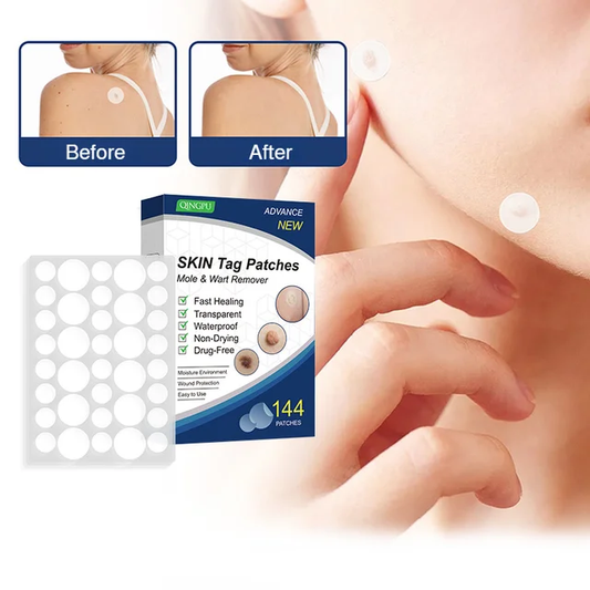 Patch Wart Flesh Mole Acne Patch Beauty Skin Care No Pain Easy To Operate