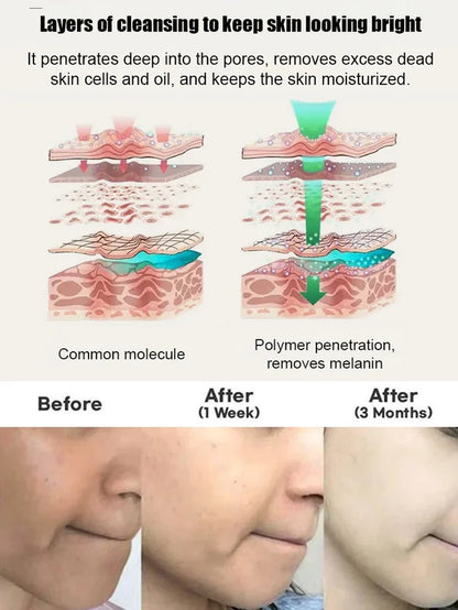Niacinamide Whitening Soap