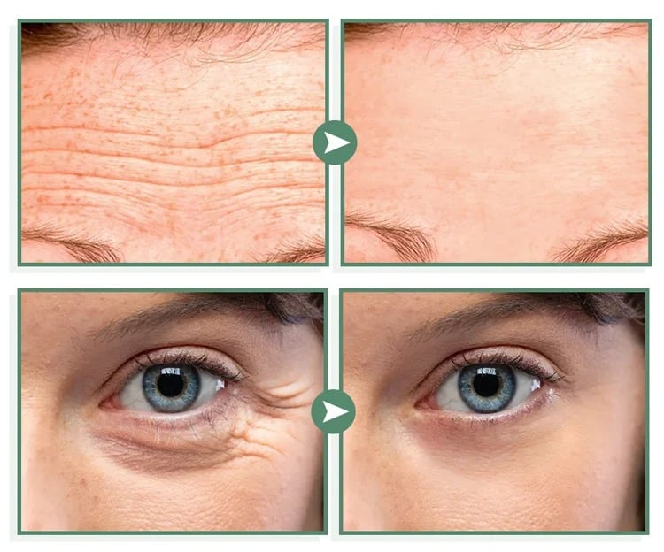 Bee Venom Facial Cream