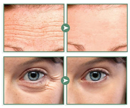 Bee Venom Facial Cream