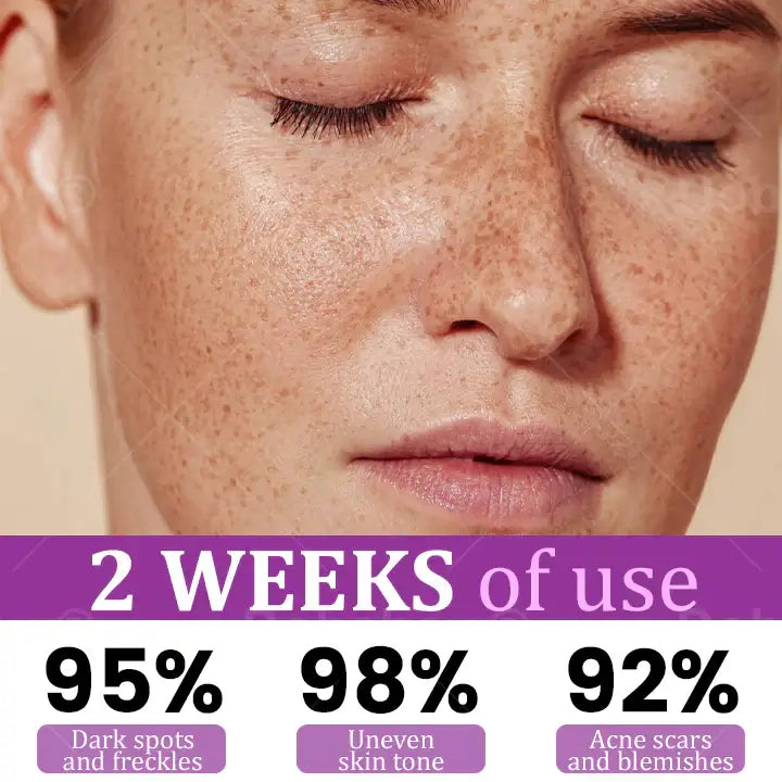 Melantrax Anti-Hyperpigmentation Essence