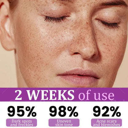 Melantrax Anti-Hyperpigmentation Essence