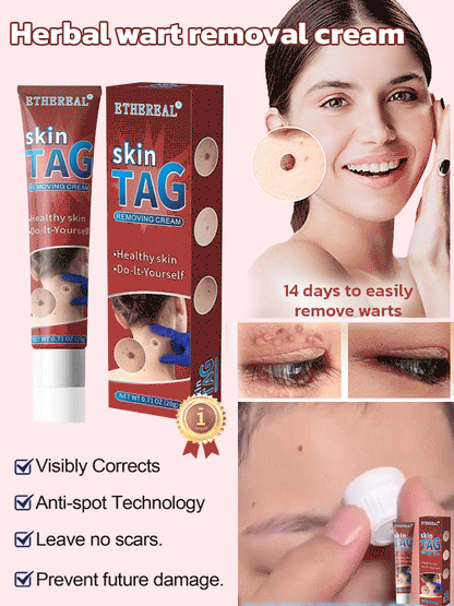 Herbal wart and corn removal cream