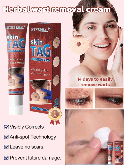 Herbal wart and corn removal cream
