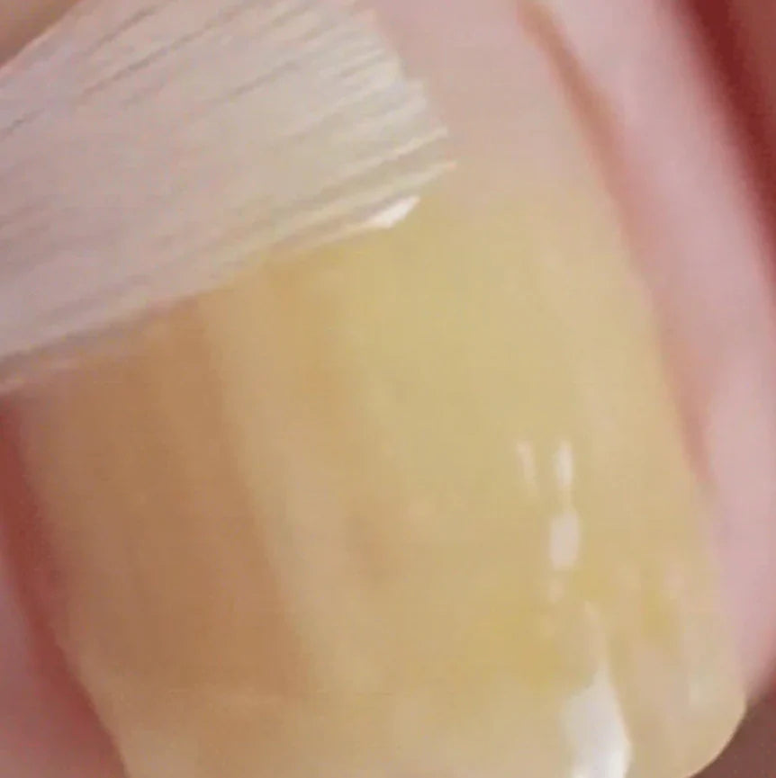 Nail Repair & Antifungal Solution