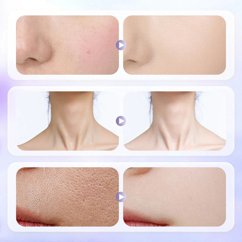 ✨ Lasting Lightweight Whitening Face Cream | CHRISTMAS MEGA SALE 52% OFF | Brightening Formula with Moisture Lock | Radiant Skin Gift Set 🎄