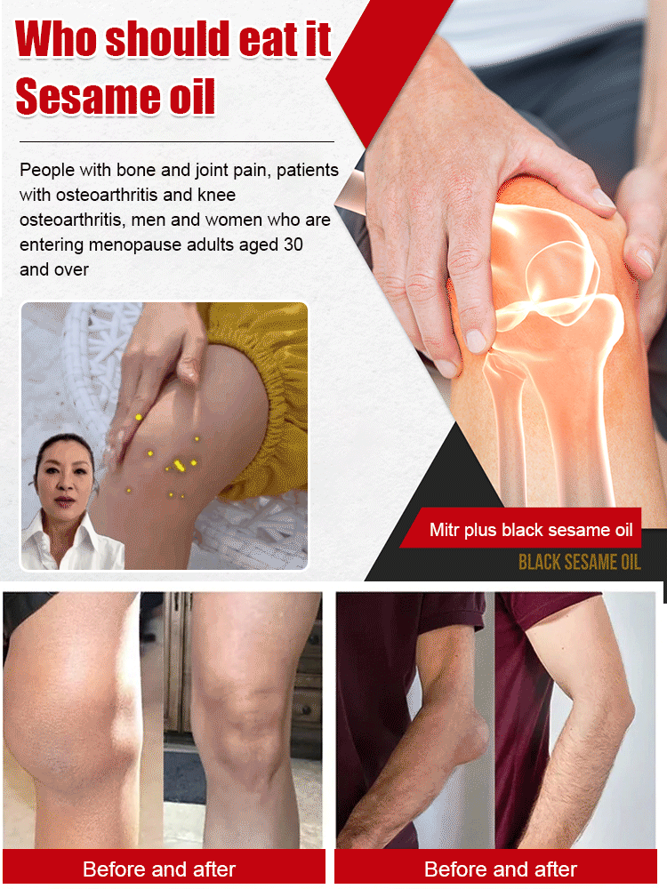 【Far infrared joint pain relief gel】Fast-acting comfort for aching joints, so you can get back to what you love!