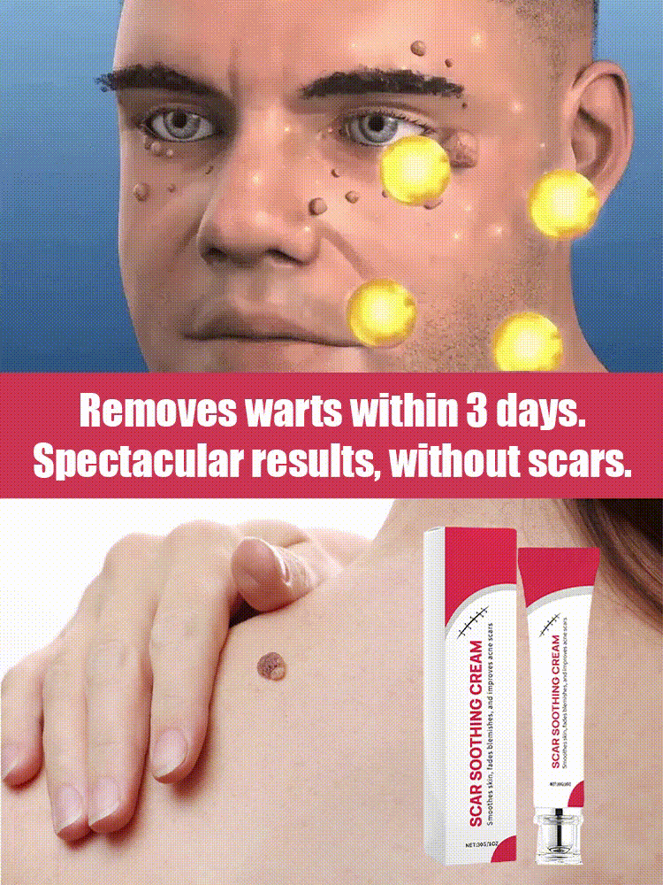 "One-Second Wart Removal" Wart Shedding Cream