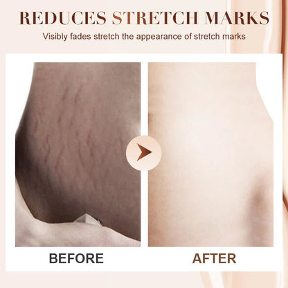 🔥Christmas Limited-Time Offer: 50% OFF!!!🔥Nourishing Hydration Skin Firming Body Cream