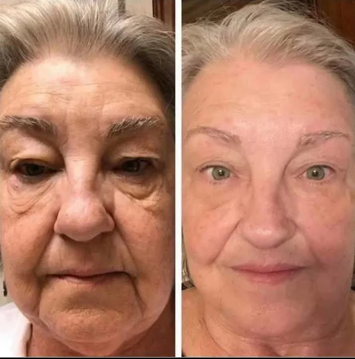 🐝🌿Ringmiz Botox BeeVenom Firming SerumStick-(Made and shippedfrom Australia)-LASTDAY 70% OFF