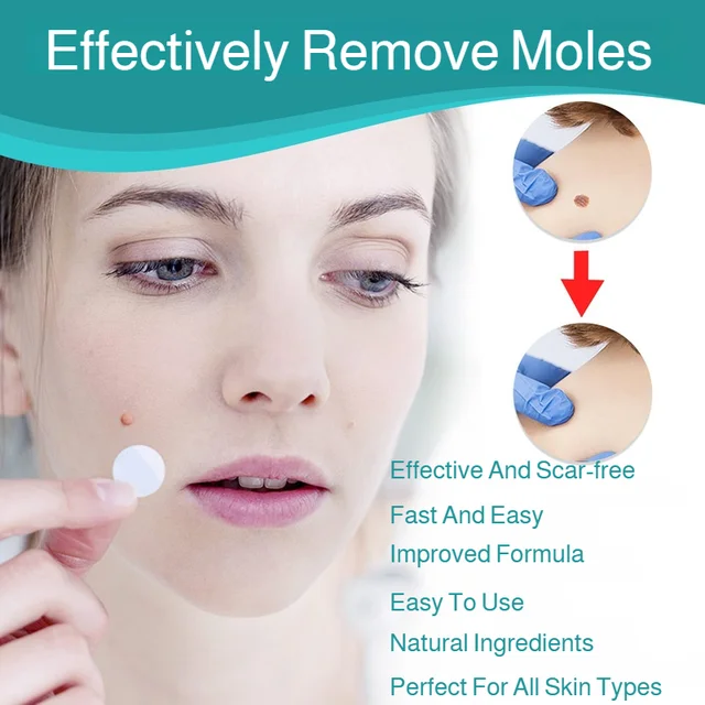 Patch Wart Flesh Mole Acne Patch Beauty Skin Care No Pain Easy To Operate