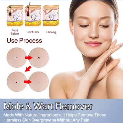Patch Wart Flesh Mole Acne Patch Beauty Skin Care No Pain Easy To Operate
